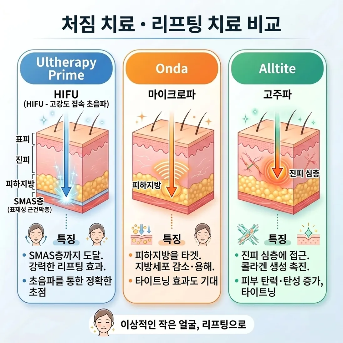 울쎄라, 온다, 올타이트 원리 분석_2.webp
