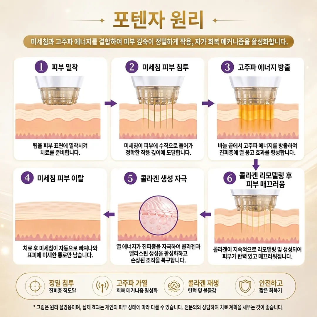 포텐자 효과와 원리.webp