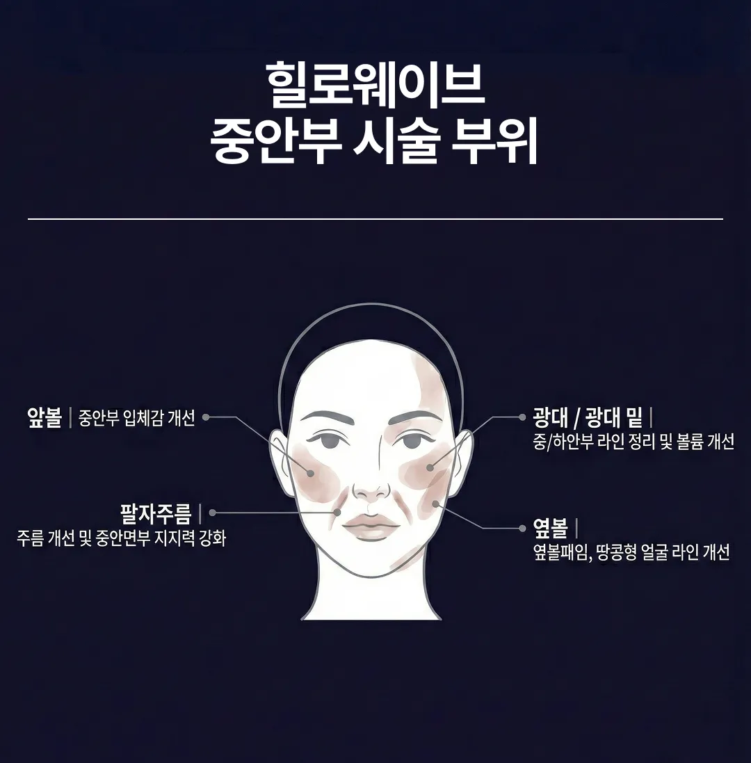 힐로웨이브 중안부 시술부위.webp