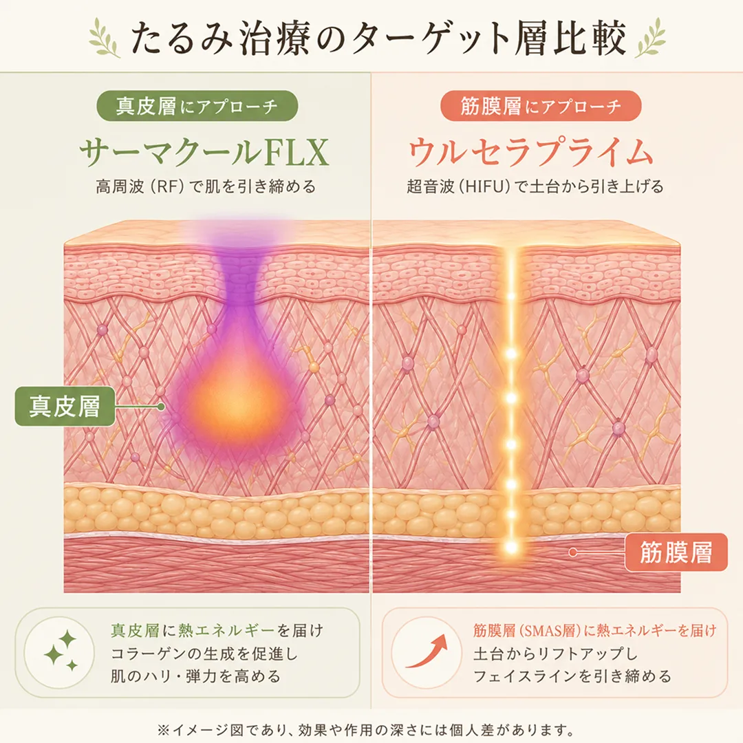 たるみ治療のターゲット層比較.webp