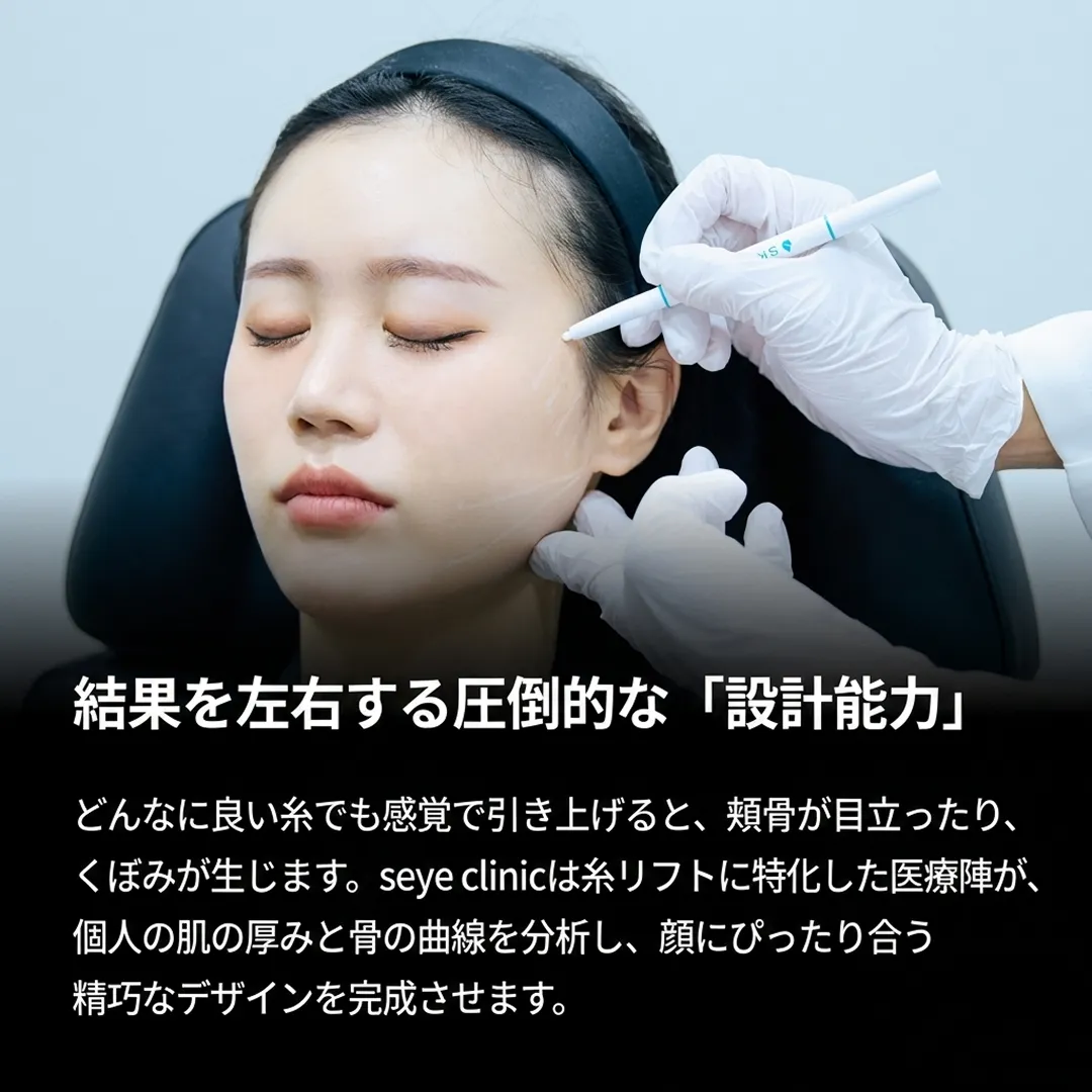 どんなに良い糸でも感覚で引き上げると、頬骨が目立ったり、くぼみが生じます。seye-ja.webp