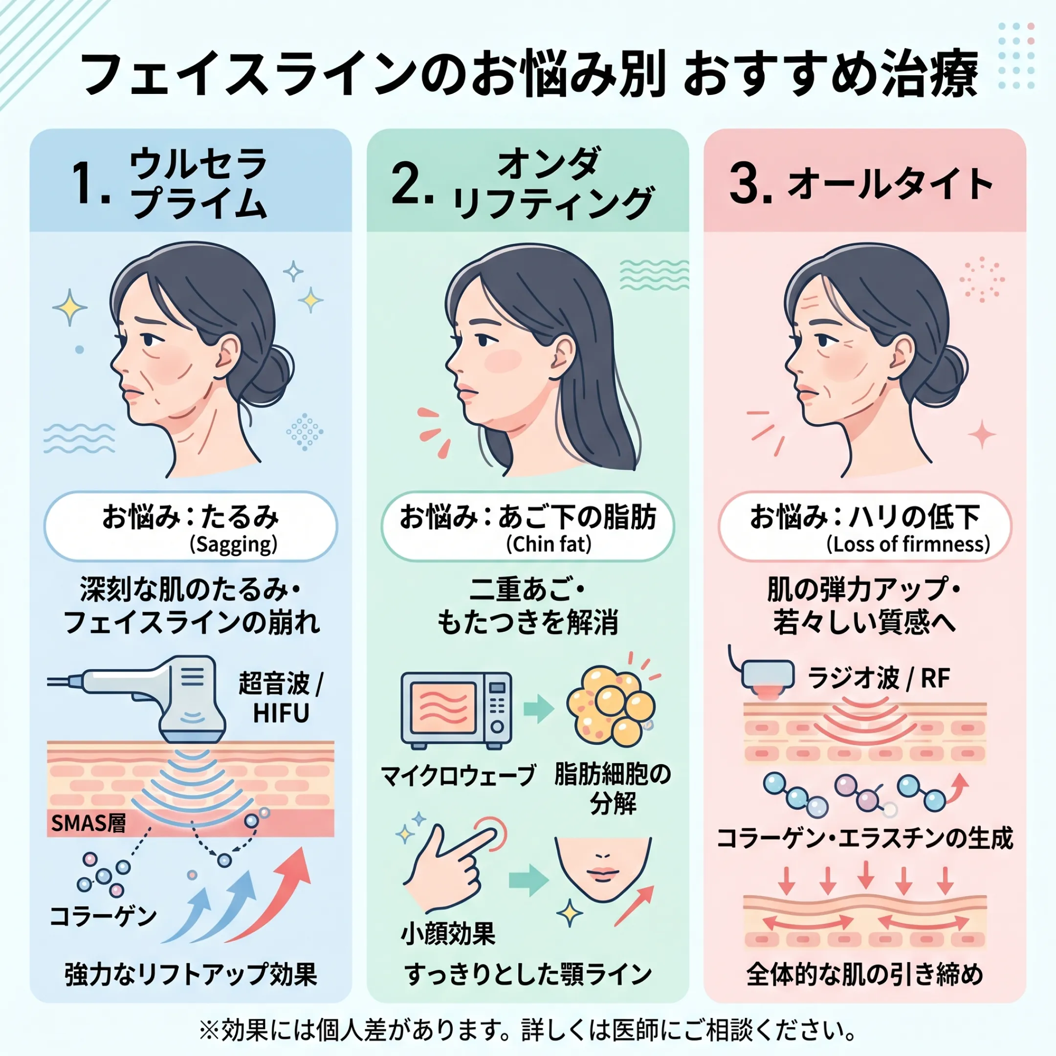 ウルセラ・オンダ・ウルタイト徹底比較2.webp