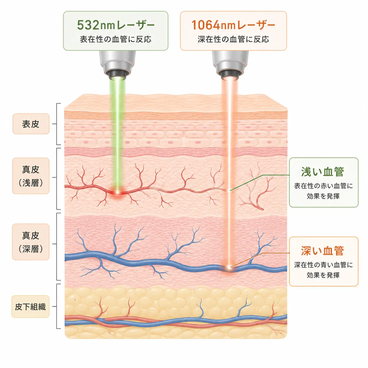 エクセルVの血管への作用機序.webp