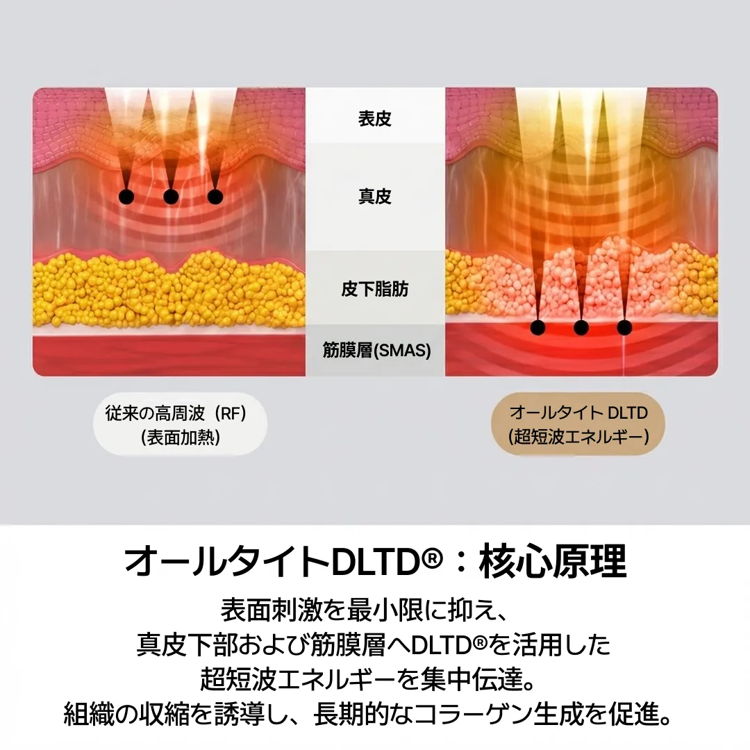 オールタイトリフティング原理-2.webp