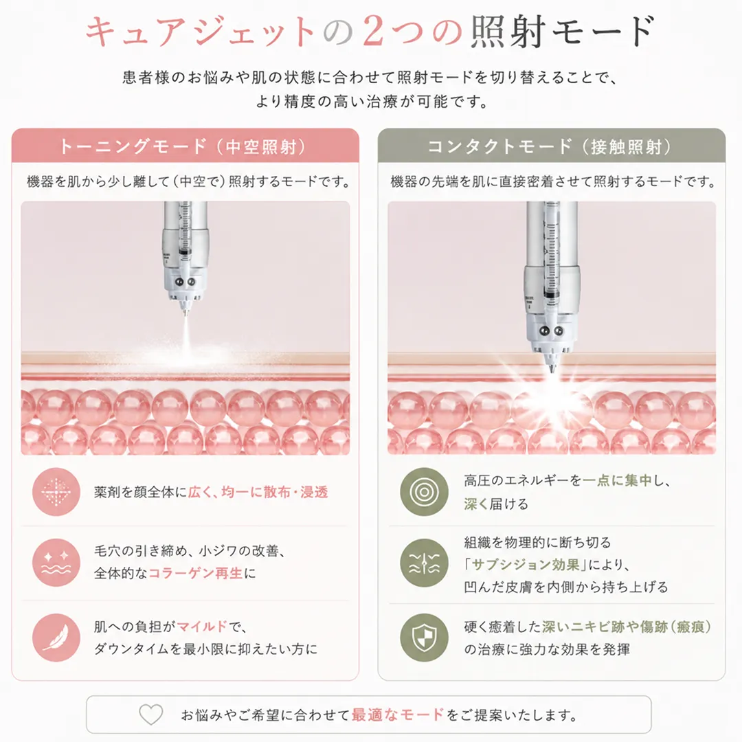 キュアジェットの2つの照射モード（接触・中空）.webp