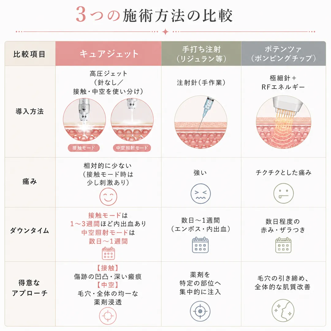キュアジェット-導入方法によるダウンタイムの違い.webp