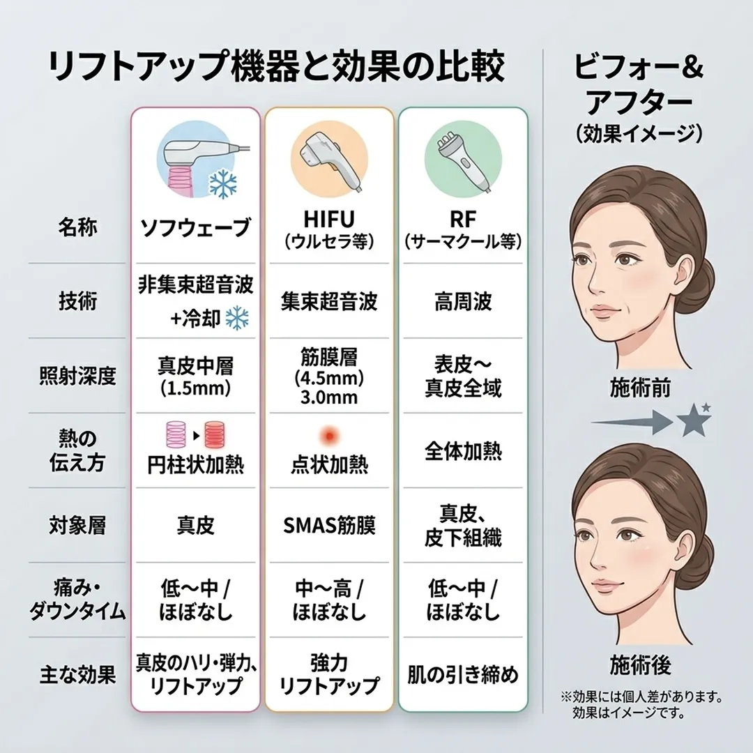 ソフウェーブと他機器の比較および施術前後のイメージ.webp