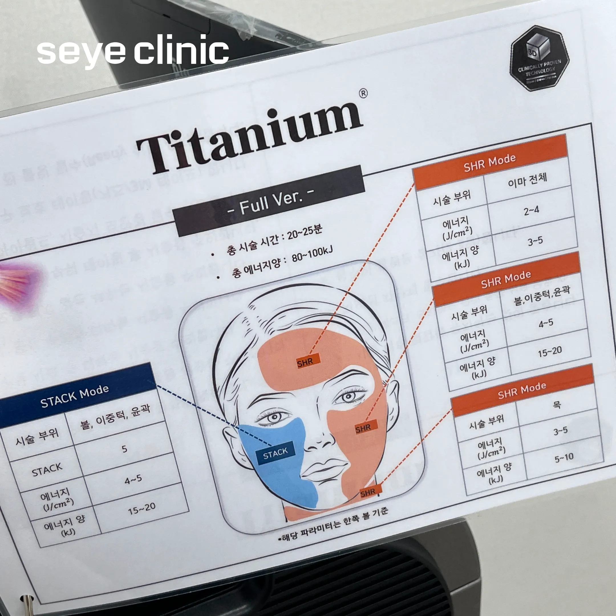 チタニウムリフティング 部位.webp