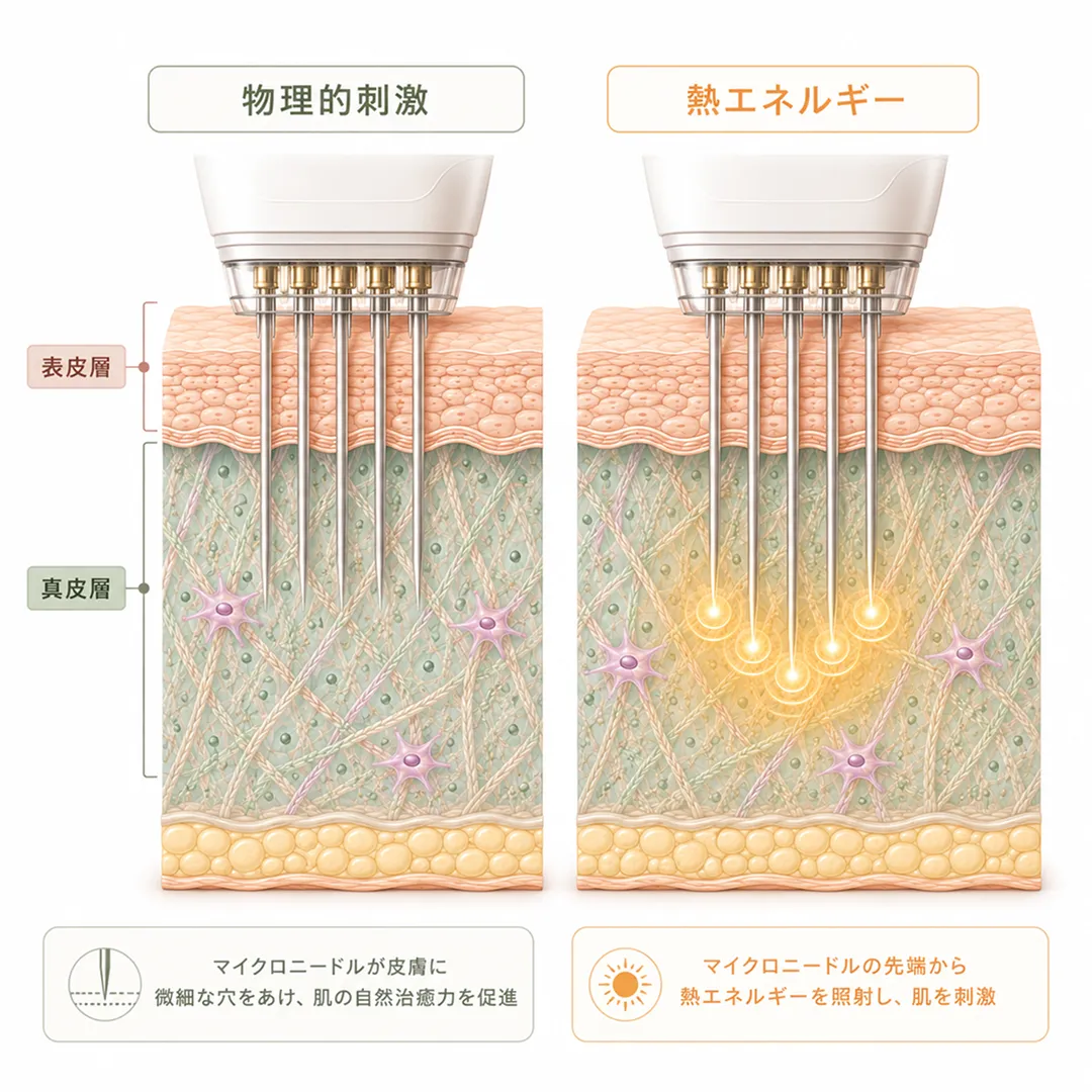 ニードルRFと通常ニードルの比較.webp