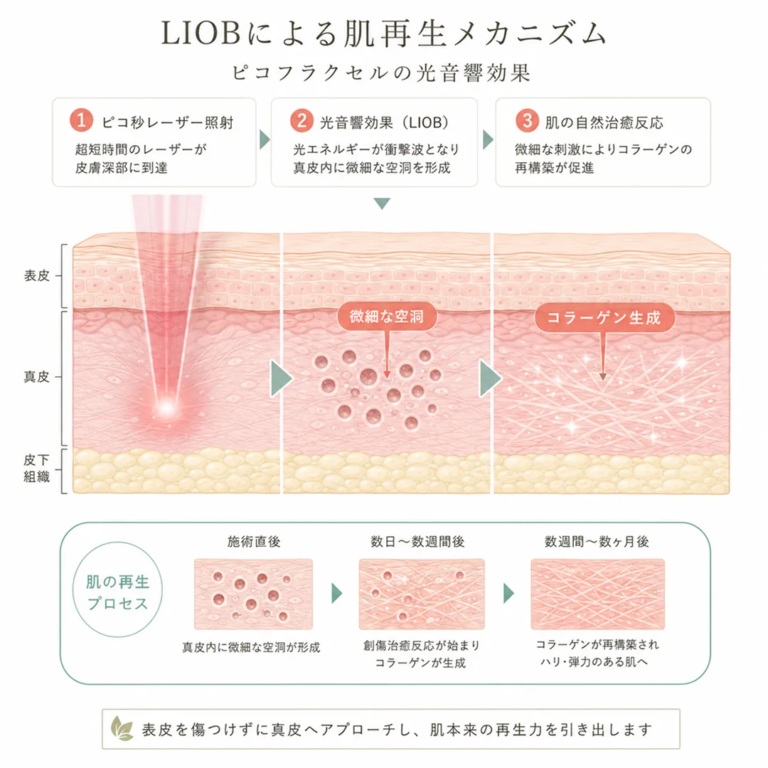 ピコフラクセルの肌再生メカニズム.webp