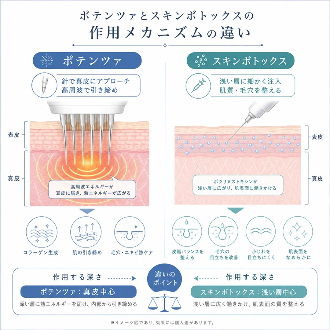ポテンツァとスキンボトックスの作用メカニズム.webp