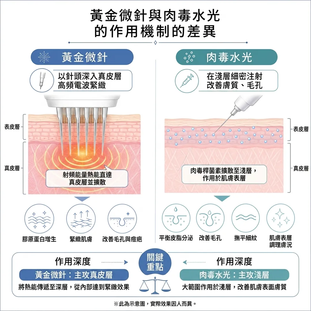ポテンツァとスキンボトックスの作用メカニズム-黃金微針與肉毒水光的-以針頭深入真皮層-作用機制的差異-在淺層細密注射-zh-tw.webp