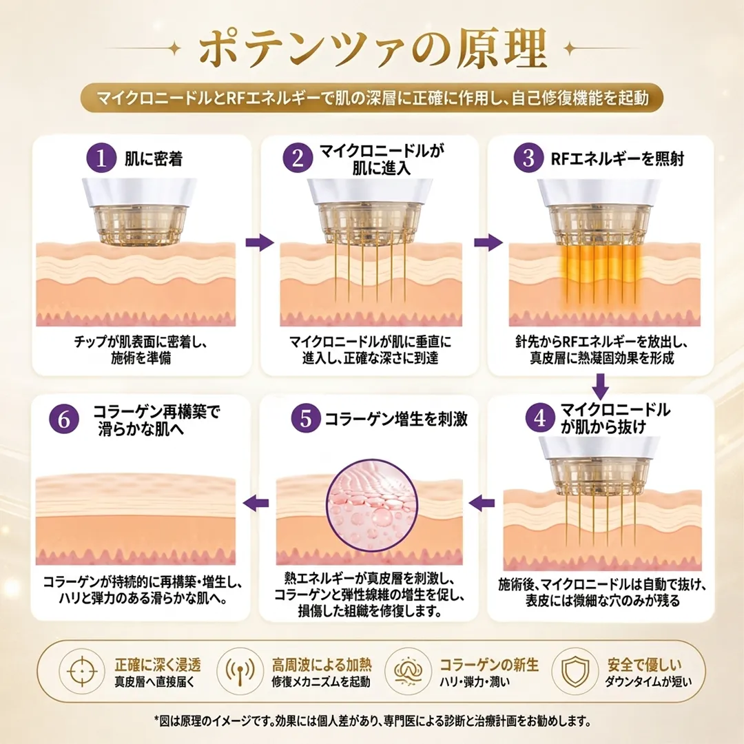 ポテンツァの原理_江南クリニック.webp