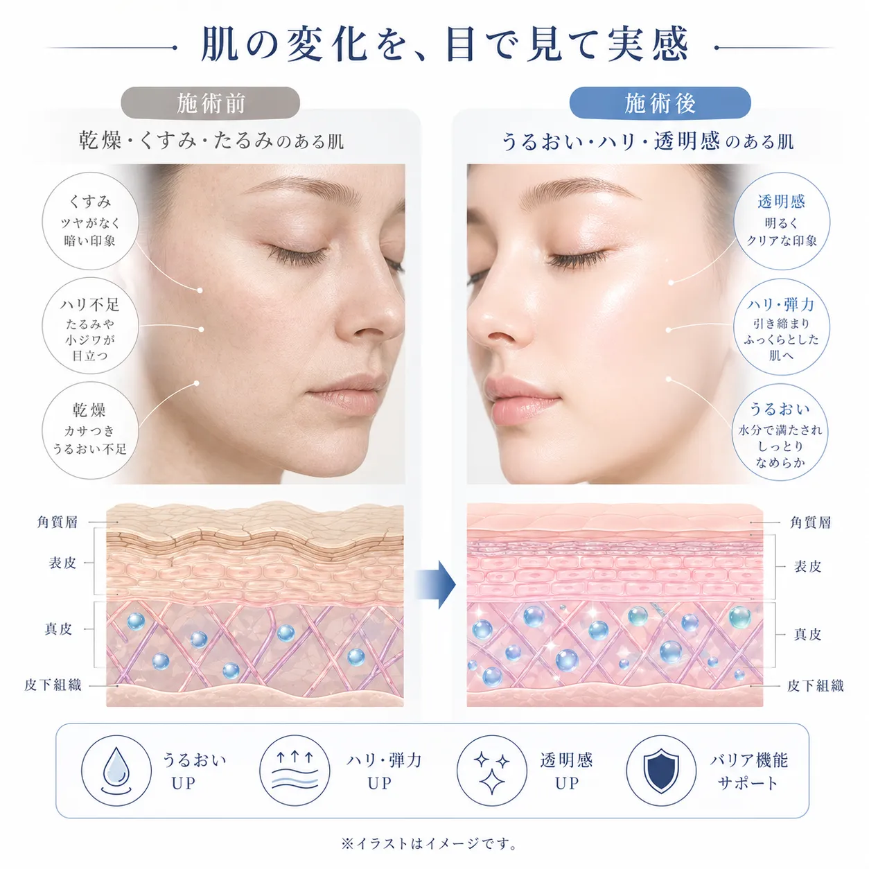 リジュランHB Plusの期待される変化.webp