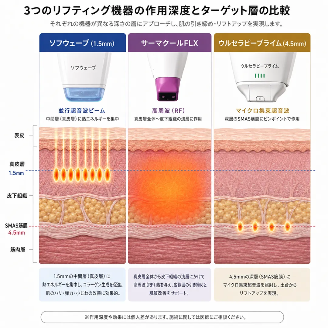 リフティング施術のターゲット層比較_ウルセラ_ソフウェーブ_サーマクール.webp