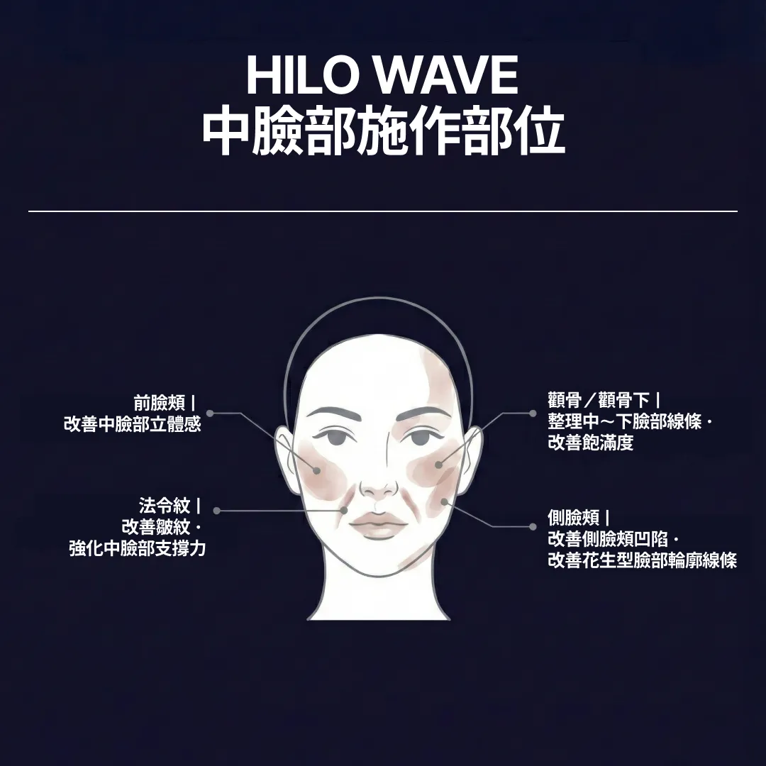 中臉部施作部位.webp