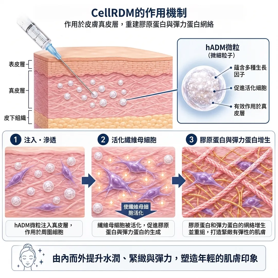 作用於皮膚真皮層,重建膠原蛋白與彈力蛋白網絡-CellRDM的作用機制-hADM微粒-zh-tw.webp