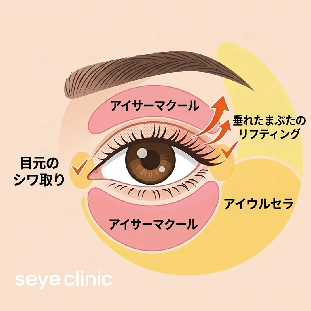 垂れたまぶたのリフティング-アイサーマクール-ja.webp