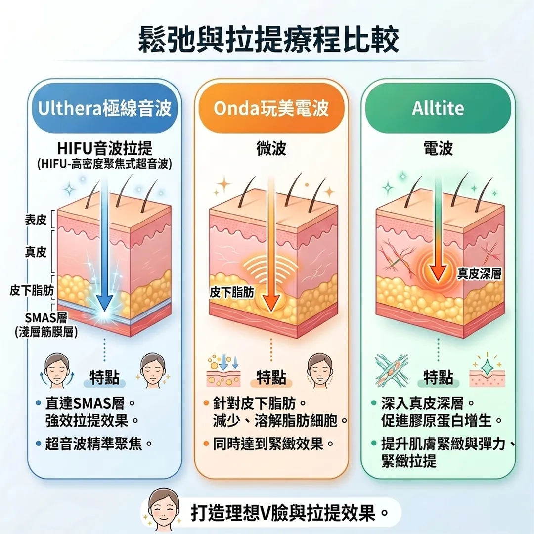 徹底比較-1-HIFU-高密度聚焦式超音波-Ulthera極線音波-鬆弛與拉提療程比較-Onda玩美電波-zh-tw.webp