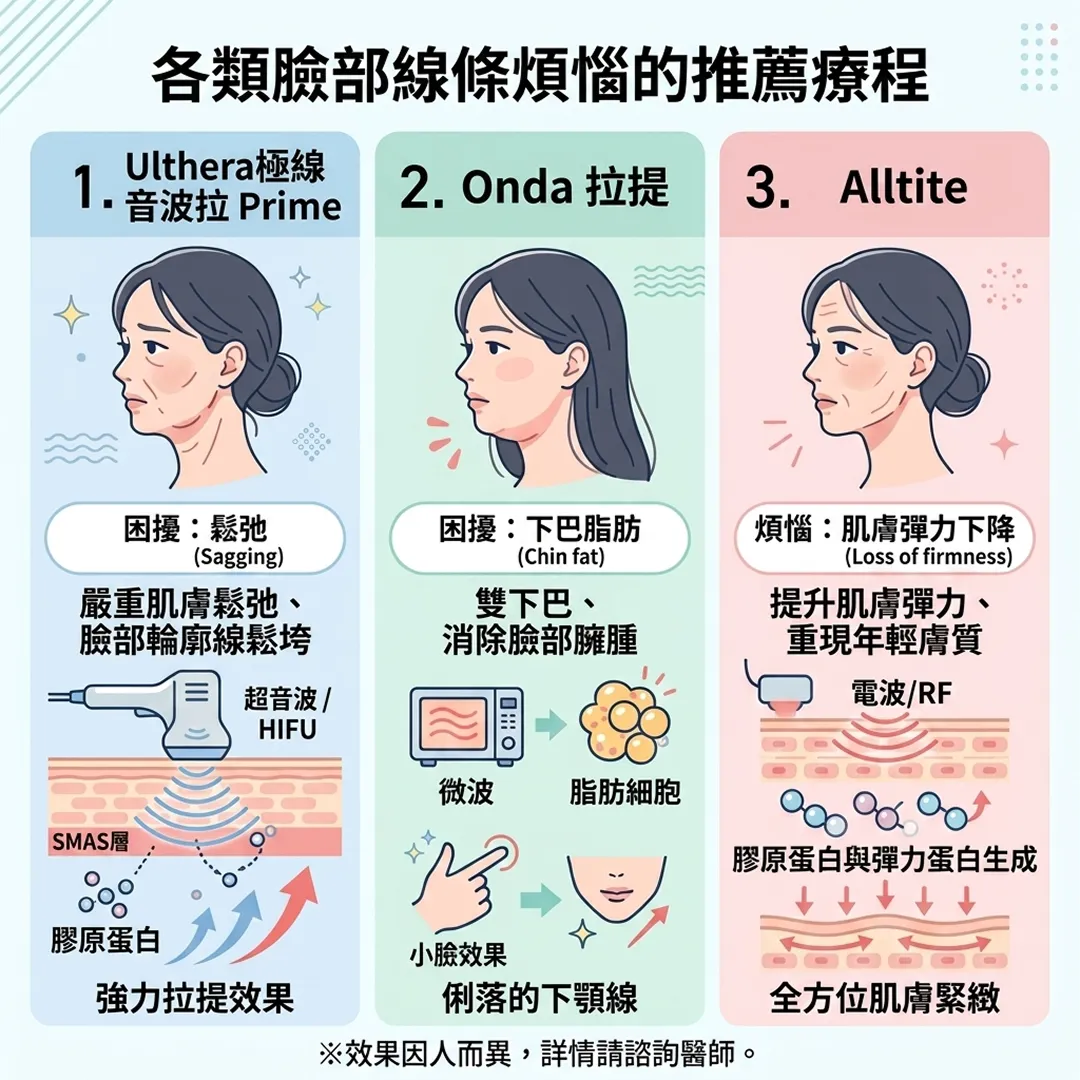 徹底比較2-1-Ulthera極線音波拉-3-Alltite-2-Onda-各類臉部線條煩惱的推薦療程-zh-tw.webp