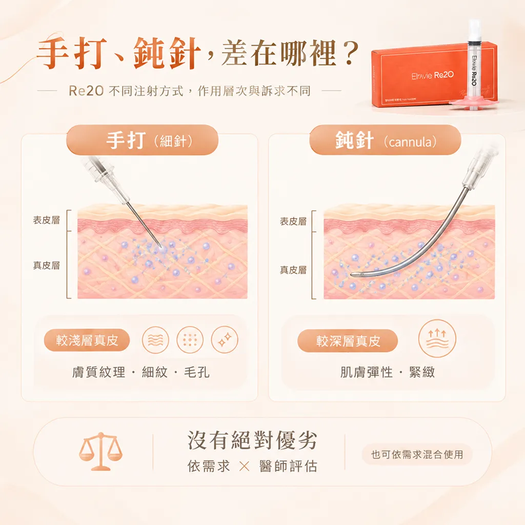 手打、鈍針，差異示意-re2o-manual-cannula-difference-seyeclinic.webp.webp