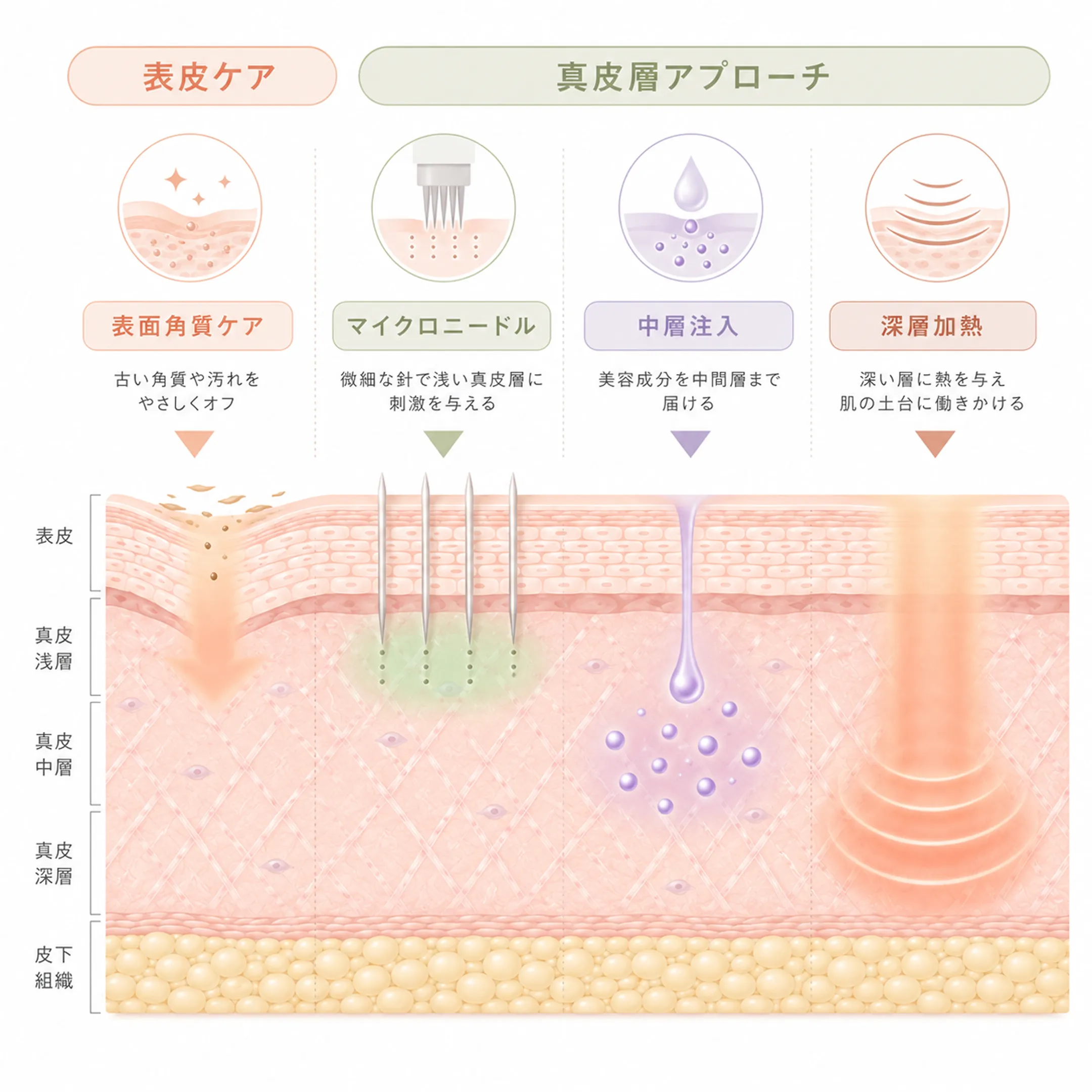毛穴アプローチの層別比較.webp