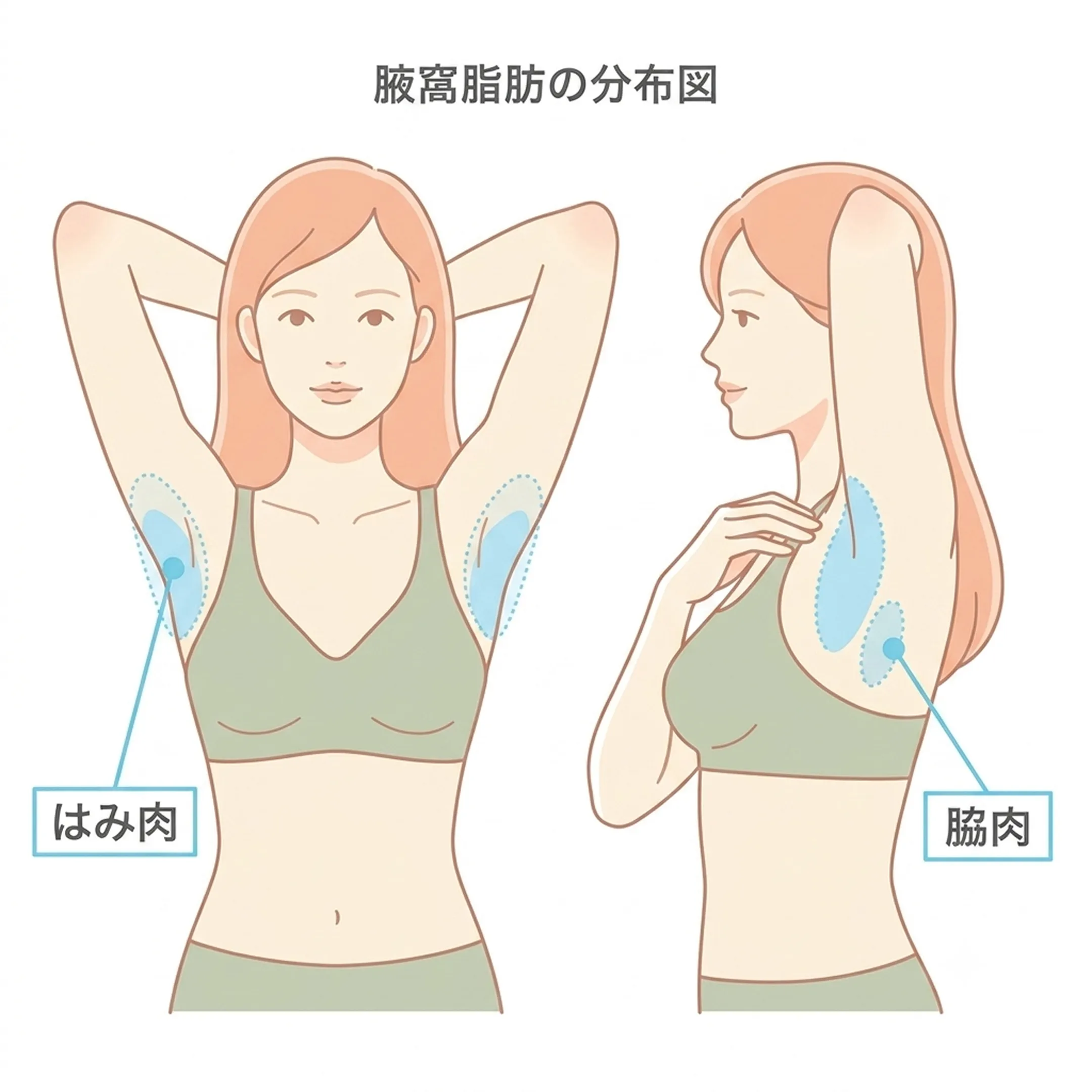 照射と注入のアプローチ比較.webp