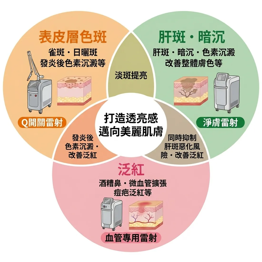 發炎後色素沉澱等-改善整體膚色等-表皮層色斑-淡斑提亮-zh-tw.webp