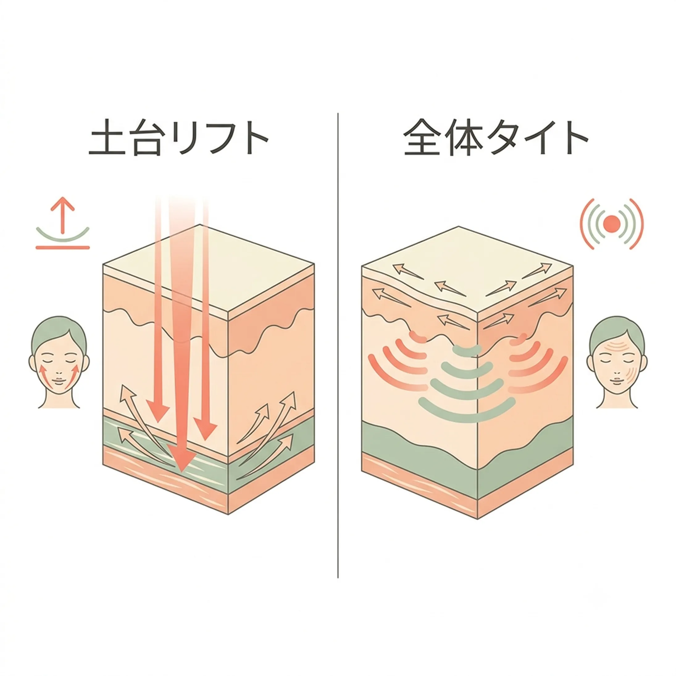 目的別に選ぶHIFU治療.webp