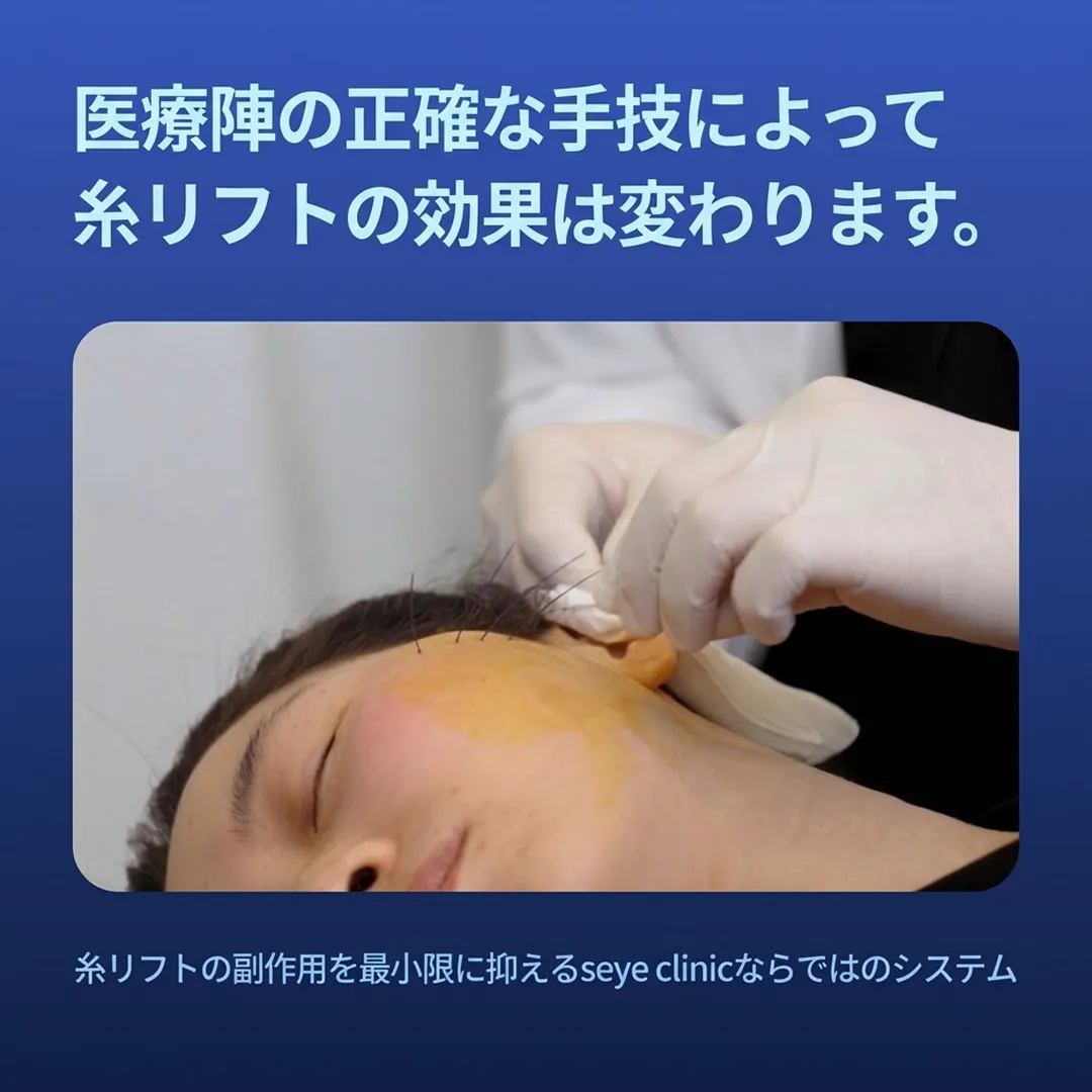 糸リフトの効果 韓国クリニック.webp