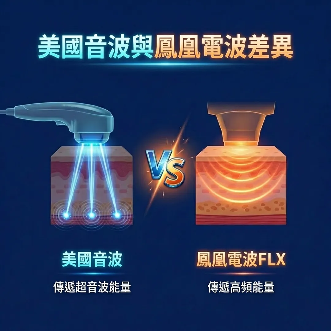 美國音波與鳳凰電波差異-傳遞超音波能量-鳳凰電波FLX.webp