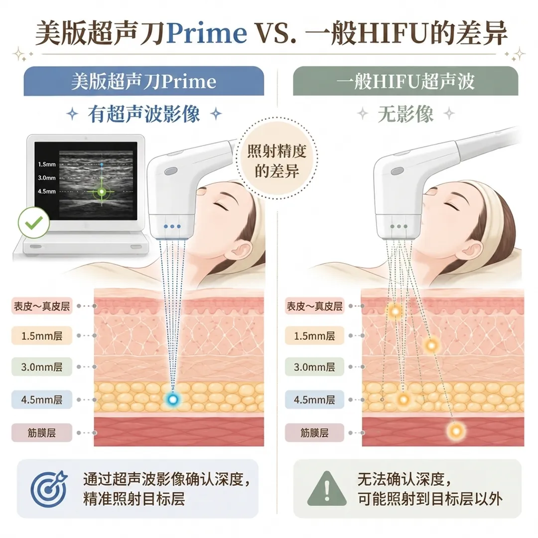 美版超声刀Prime-VS-一般HIFU-1-5mm-3-0mm-zh.webp