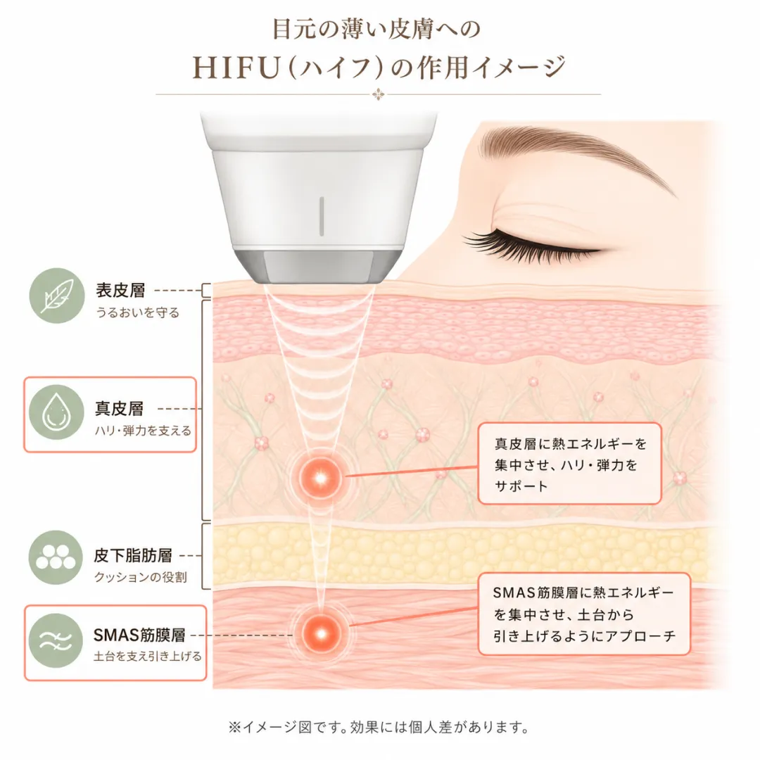 韓国美容皮膚科_アイウルセラの作用メカニズム.webp