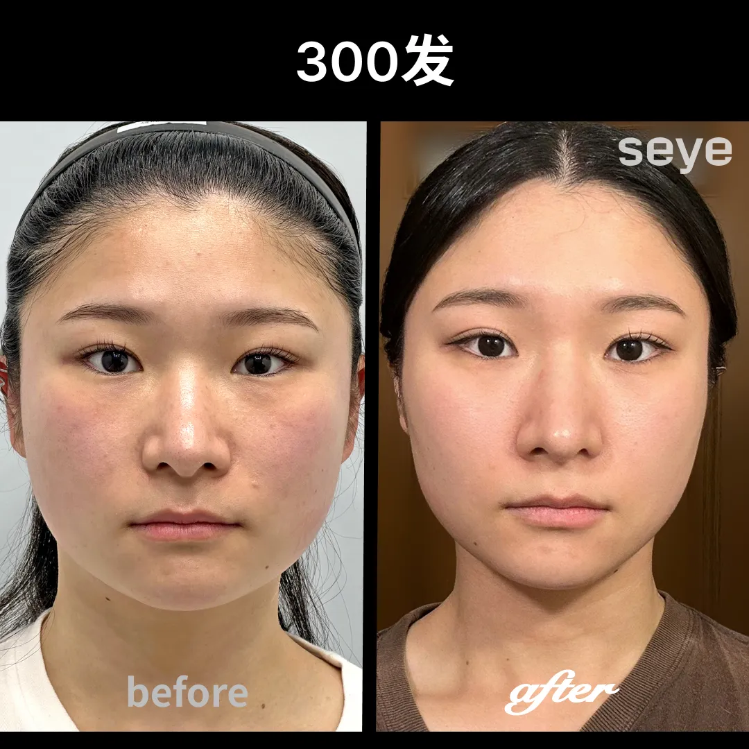音波300.webp