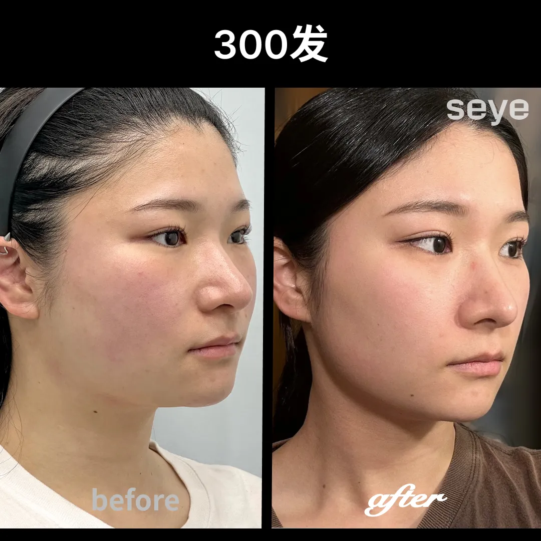 音波300_2.webp