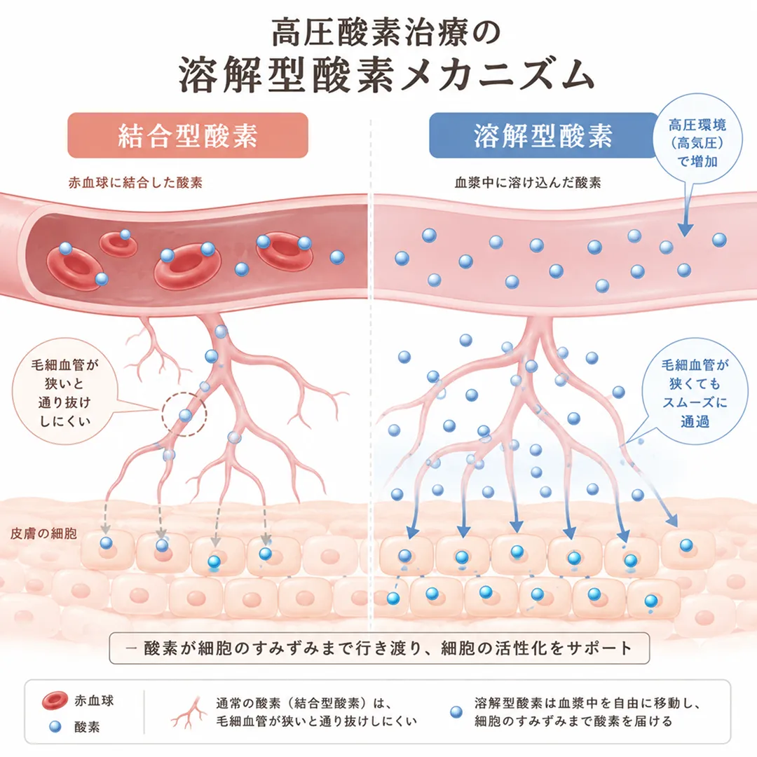 高圧酸素治療のメカニズム.webp