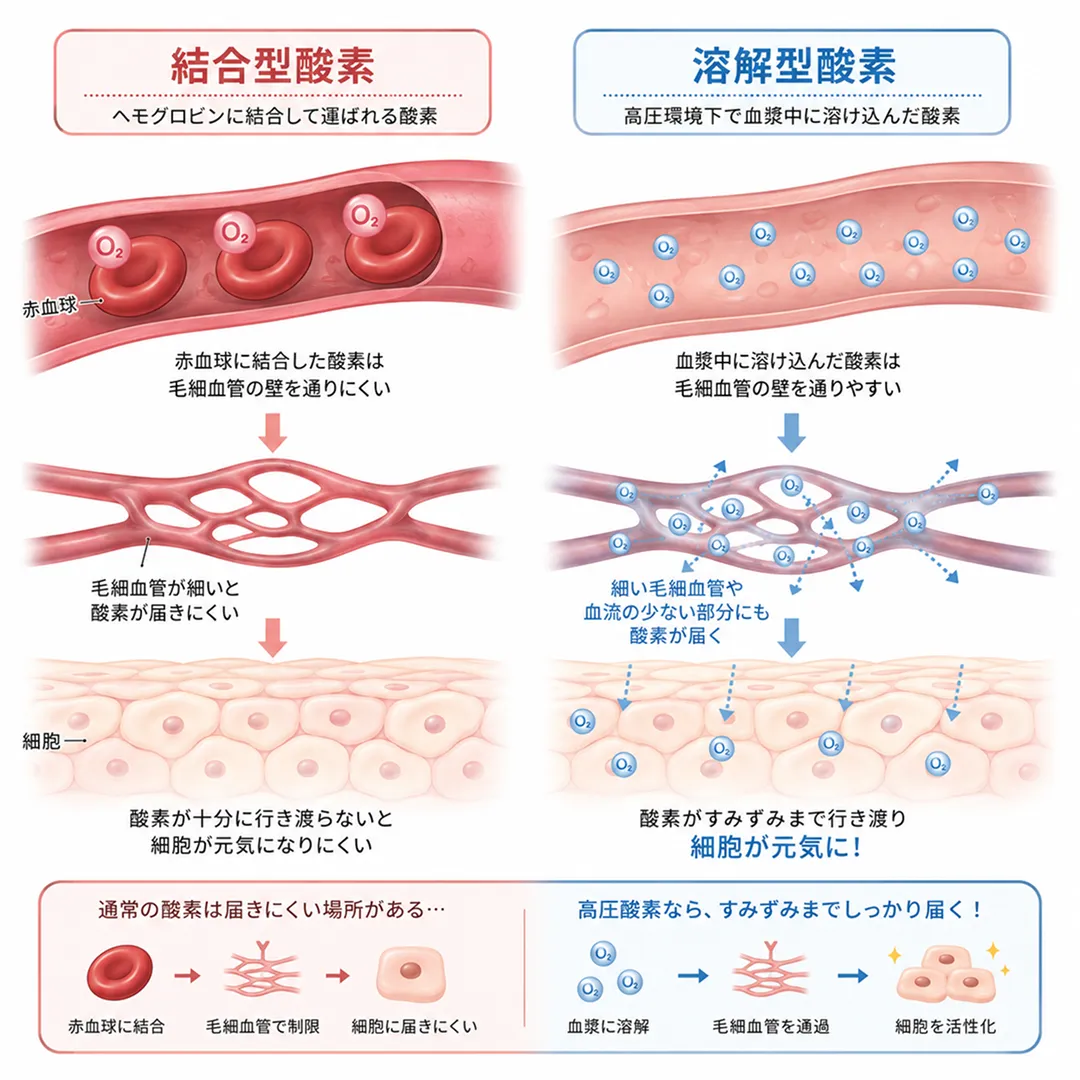 高圧酸素治療の溶解型酸素メカニズム.webp