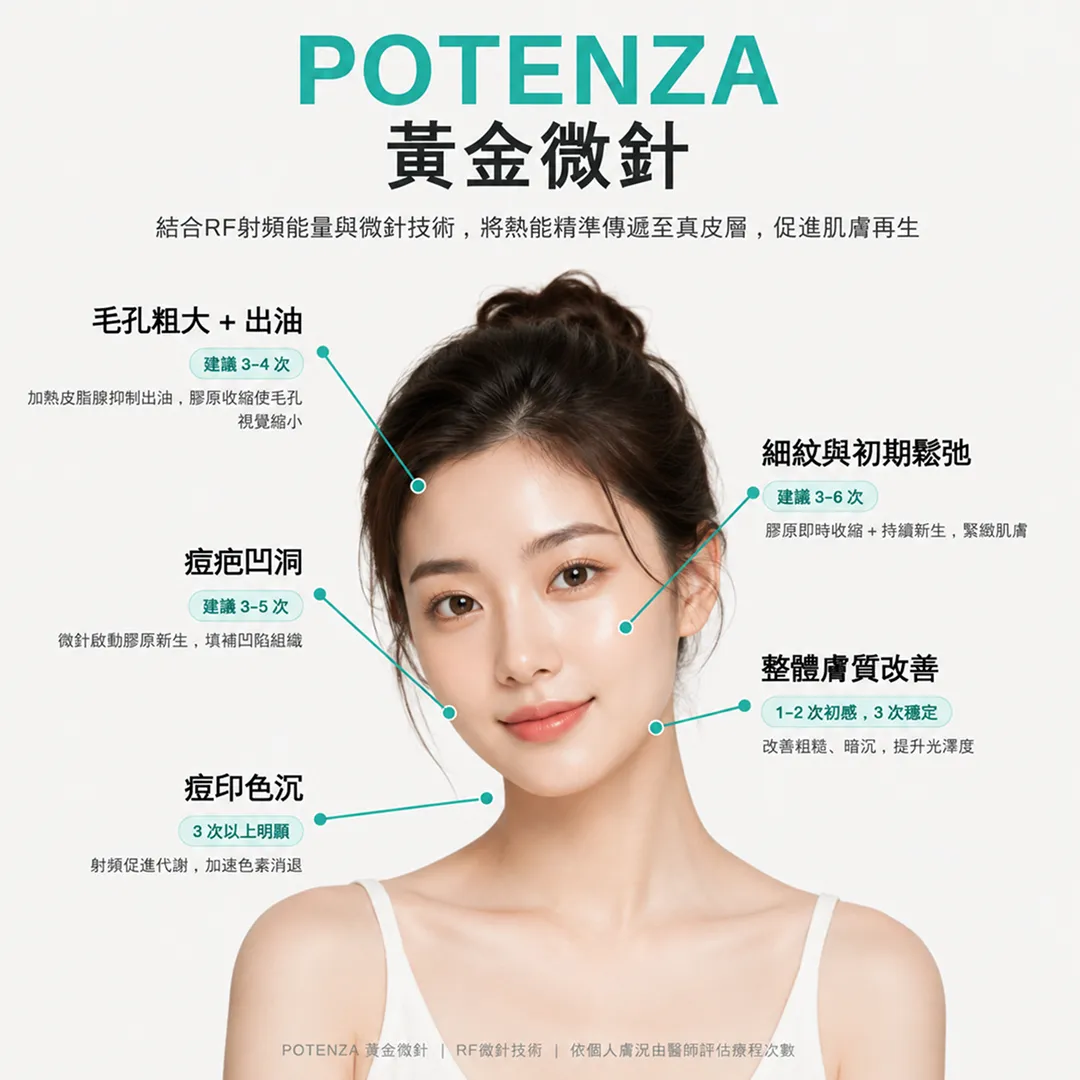 黃金微針射頻作用真皮層膠原新生機制示意圖-gold-microneedling-rf-dermis-collagen-mechanism-seyeclinic.webp