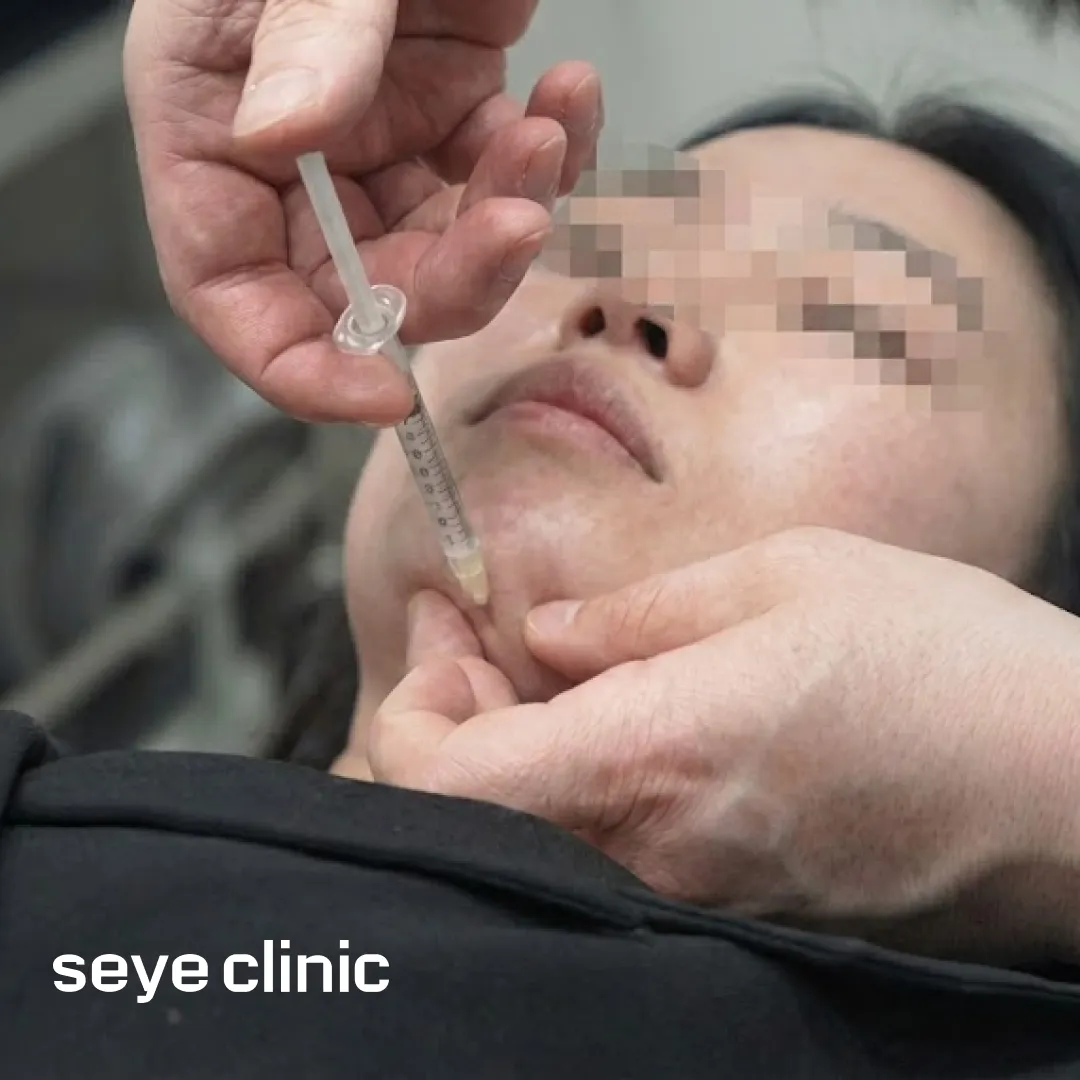 나이테주사 이중턱주사.webp