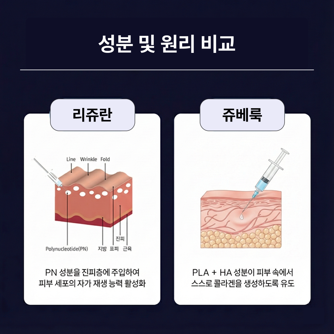 리쥬란 쥬베룩 원리 차이 비교