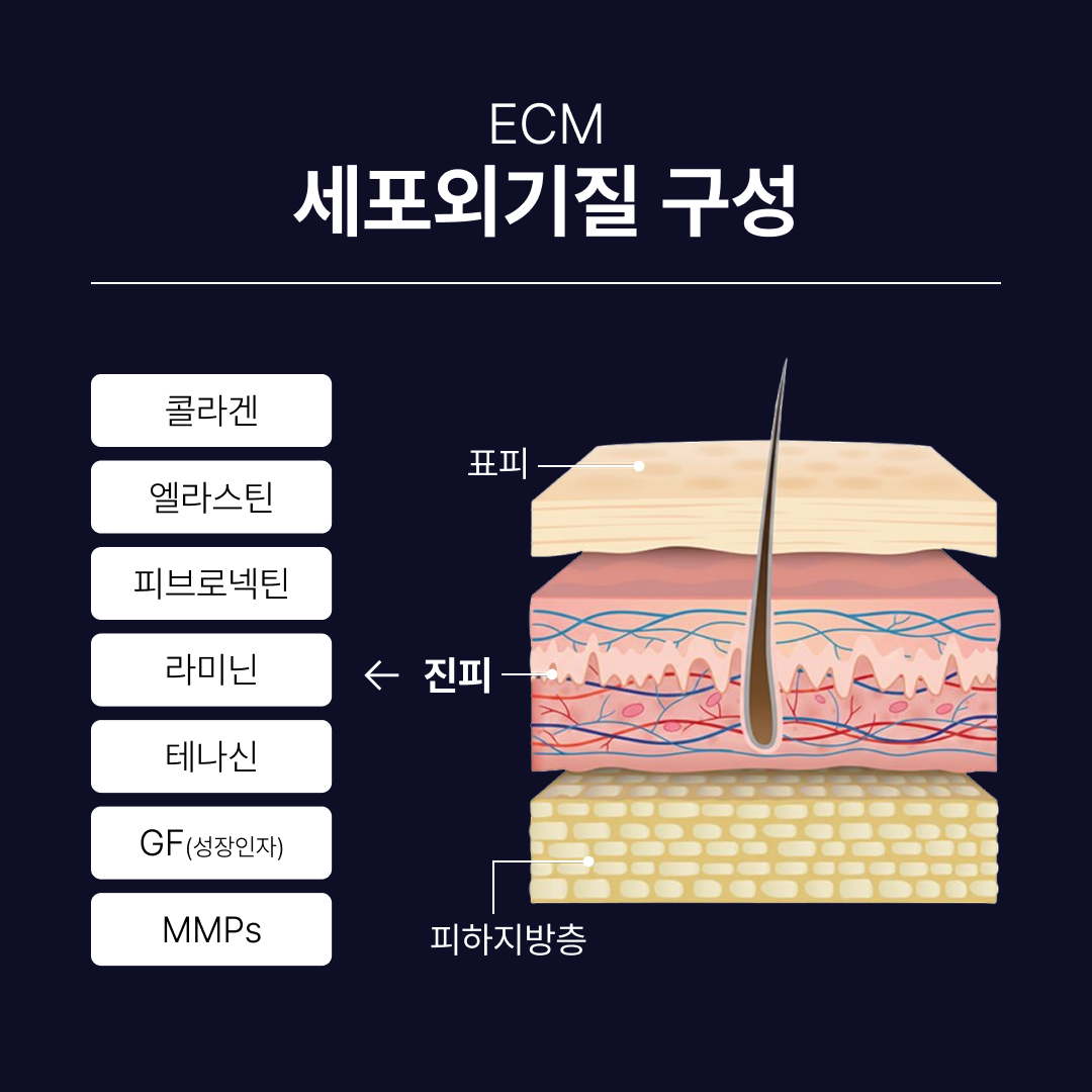 리투오눈밑 ECM 구성.png