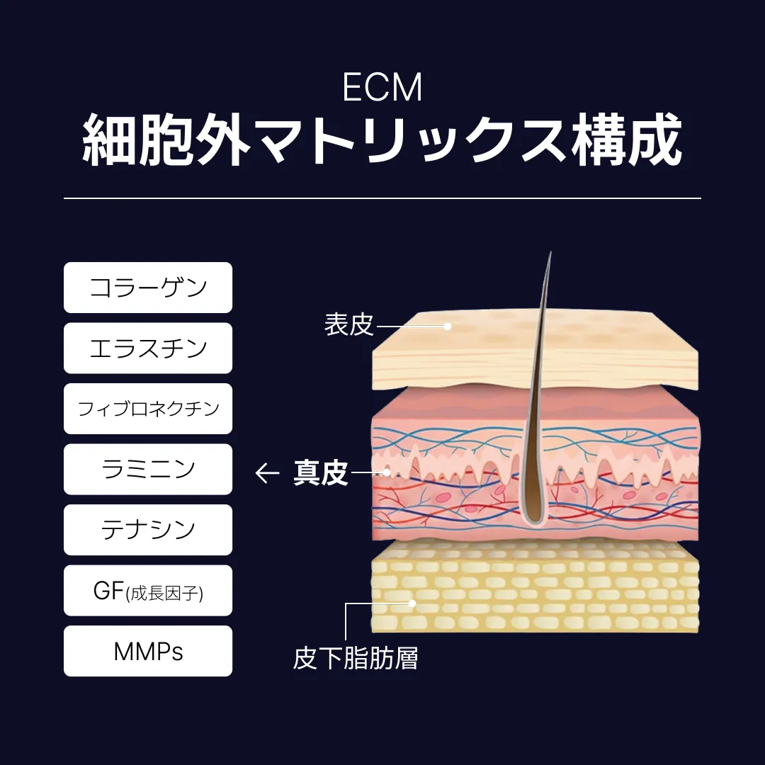 리투오눈밑 ECM 구성.webp
