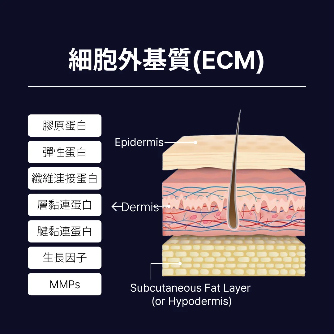 리투오눈밑 ECM 구성_CN.webp