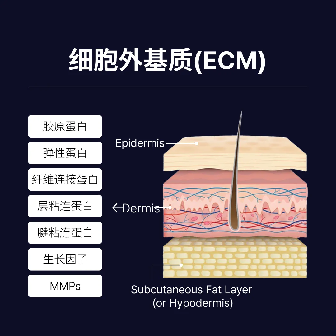 리투오눈밑-ECM-구성_CN.webp