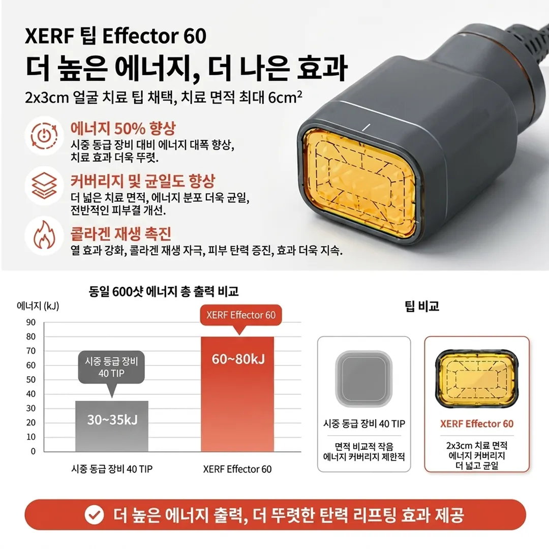 세르프 팁 에너지