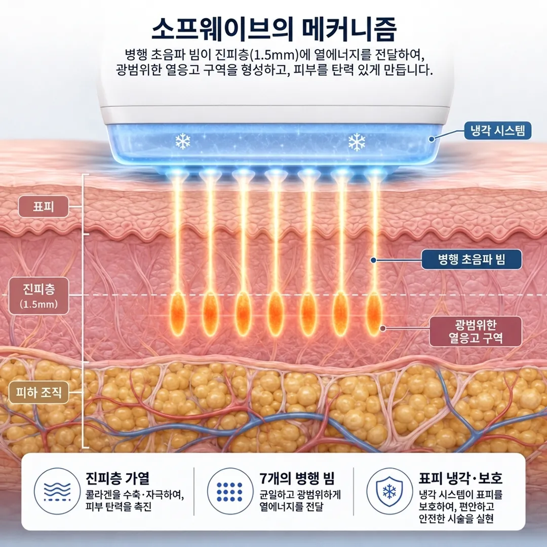 소프웨이브 원리-1.webp