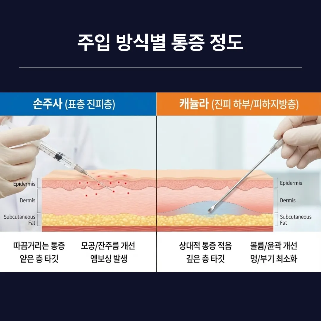 손주사 캐뉼라 통증 비교.webp