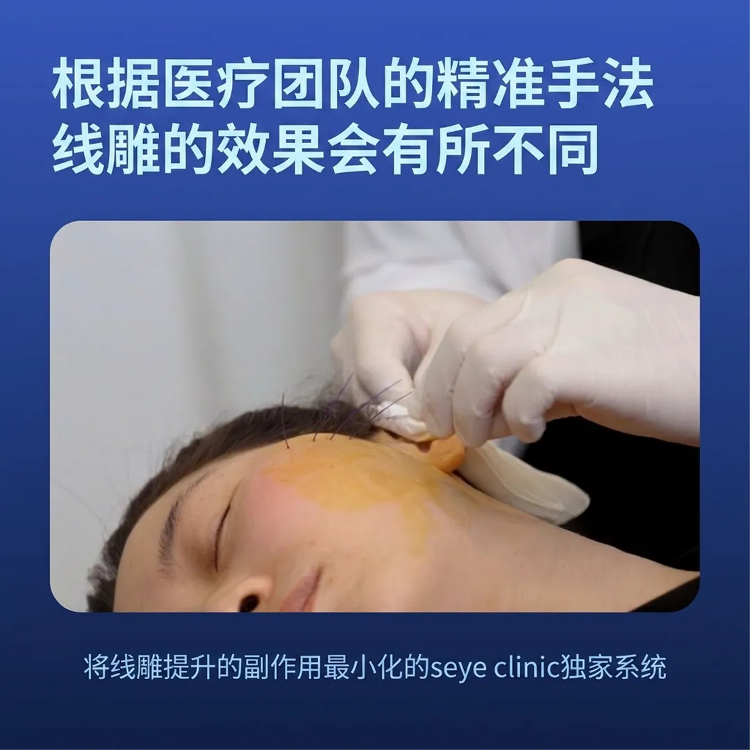 실루엣소프트-seye-clinic-将线雕提升的副作用最小化的seye-clinic独家系统-根据医疗团队的精准手法-线雕的效果会有所不同-zh-cn.webp