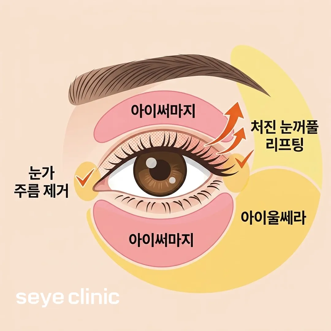아이써마지 아이울쎄라