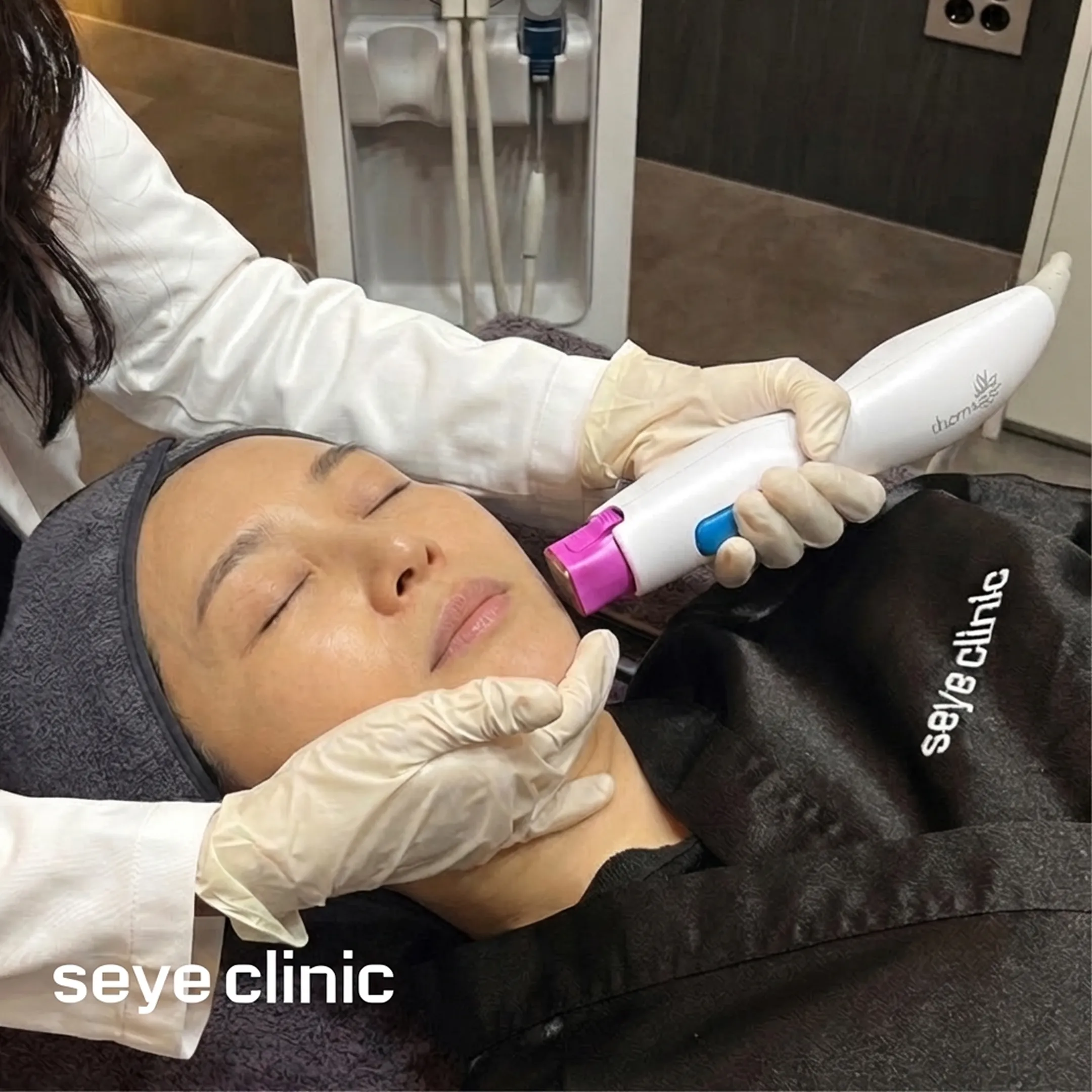 아이써마지效果-seye-clinic-thermage-鳳凰電波效果-zh-tw.webp